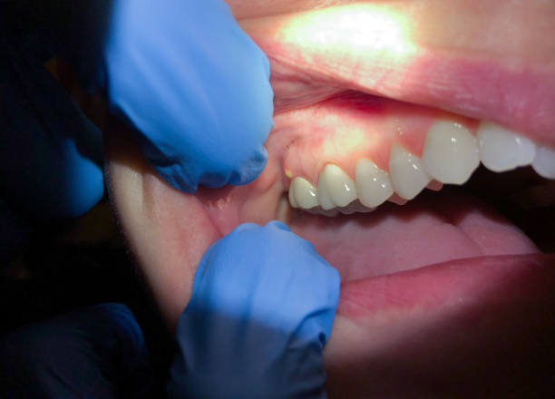 Best Emergency Treatment for Jaw Pain or Injury in Centerville, IA